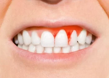 دراسة تكشف.. صحة الفم السيئة تزيد من خطر الإصابة بفشل القلب والسكتة الدماغية