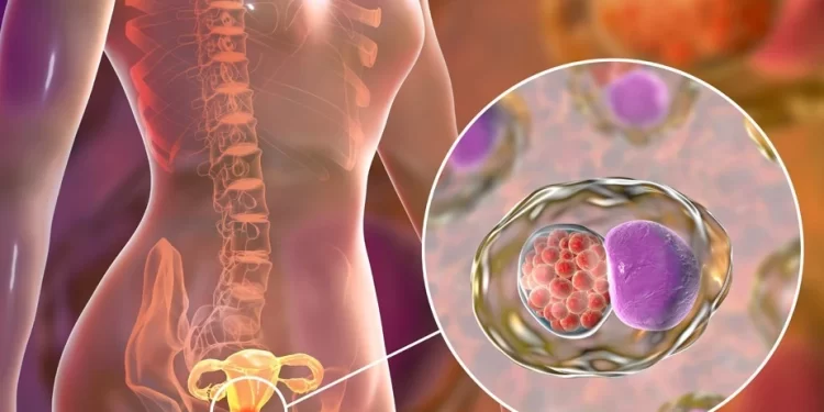 أكبر تقدم طبي منذ 25 عاماً.. علاج جديد لسرطان عنق الرحم يقلل الوفيات بنسبة 40% 1 أكبر تقدم طبي منذ 25 عاماً.. علاج جديد لسرطان عنق الرحم يقلل الوفيات بنسبة 40%