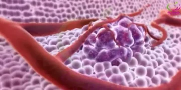 ابتكار جهاز رخيص للكشف المبكر عن السرطان بدقة خلال ساعة واحدة