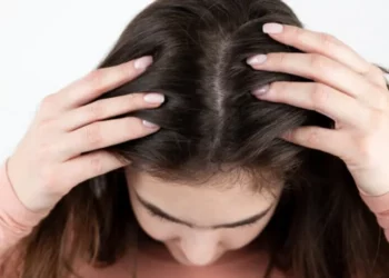 قشرة الشعر.. المشكلة التي تتفاقم شتاء