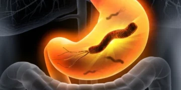 جرثومة المعدة