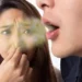 رائحة الفم الكريهة.. طبيب يشرح أسبابها وطرق التخلص منها 8 رائحة الفم الكريهة