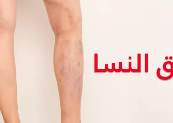 كيف أعلم أني مصاب بعرق النسا؟ كيفية التعامل مع عرق النسا.. الأعراض والأسباب وطرق العلاج الفعالة