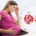 فقر الدم أثناء الحمل ـ تعرفي على أسبابه وكيفية تجنبه بطرق طبيعية ودور التغذية والفيتامينات والمعادن في الوقاية 8 فقر الدم عند الحوامل