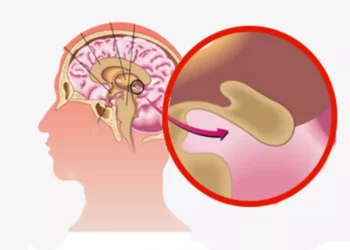 هرمون النوم السحري