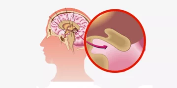 هرمون النوم السحري