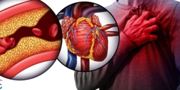 الجلطة القلبية