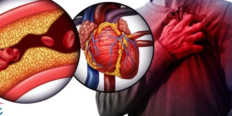طرق الوقاية من الجلطة القلبية.. دليلك لحماية القلب قبل فوات الأوان 1 الجلطة القلبية