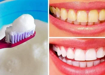 طرق تبييض الأسنان في المنزل