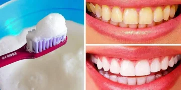 طرق تبييض الأسنان في المنزل