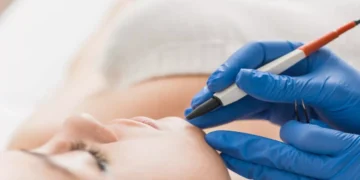 إزالة الشعر نهائيًا من الجسم ومنع نموه