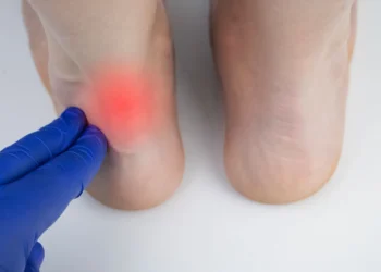 التهاب وتر أخيل