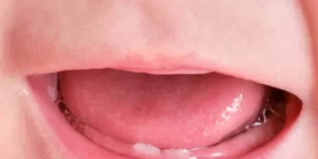 هل التسنين يسبب حرارة؟