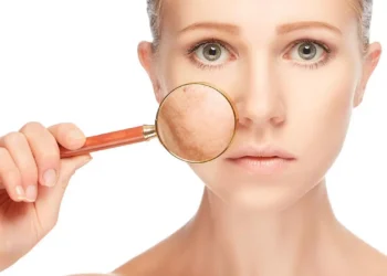 نضارة البشرة بعد الولادة