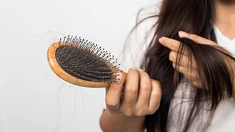 أسباب تساقط الشعر عند النساء
