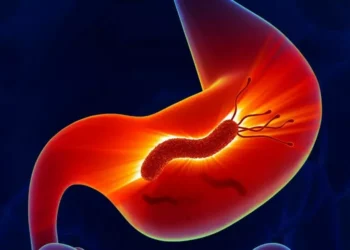 أسباب جرثومة المعدة