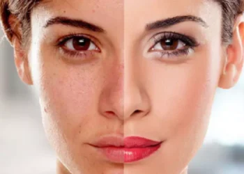 تفتيح البشرة بطريقة طبيعية