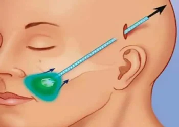 كيف يعمل شد الوجه بالمنظار على استعادة شبابك مرة أخرى؟