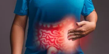 علاج القولون العصبي عند النساء.. بدائل صحية وآمنة