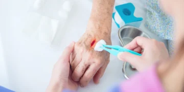 التهاب الجرح.. الأسباب والأعراض وطرق العلاج الفعالة 2 التهاب الجرح